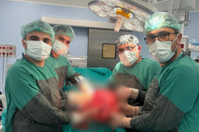 Karın ağrısıyla geldi, böbreğinden 35 cm’lik kitle çıktı