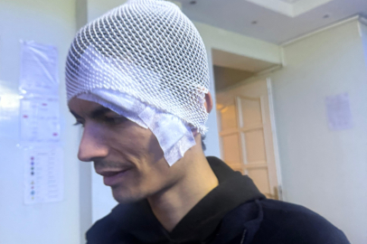 Engelli Bakım Merkezinde Darp Olayı: Gaziantep’te Genç Kafasından Yaralandı, Vücudunda İzler Dikkat Çekti