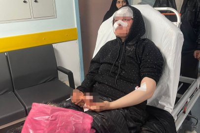 Boşanmak İsteyen Eşini Öldüresiye Döven Koca Tutuklandı