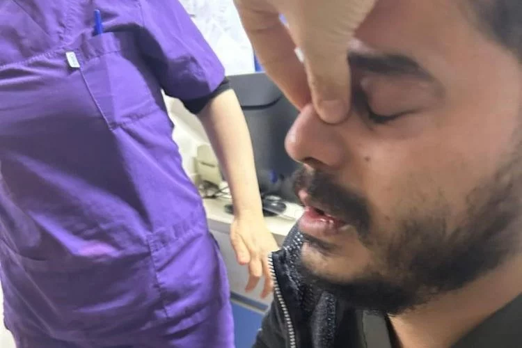 Gaziantep’te hasta yakınları doktorun burnunu kırdı